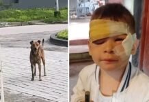 Un perro entró a una casa y atacó a un nene de 3 años.