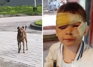 Un perro entró a una casa y atacó a un nene de 3 años.