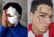 Tafí Viejo Inseguro: Hirieron a un joven durante un violento robo.