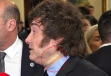 La salud de Milei: apareció con una venda en el cuello.